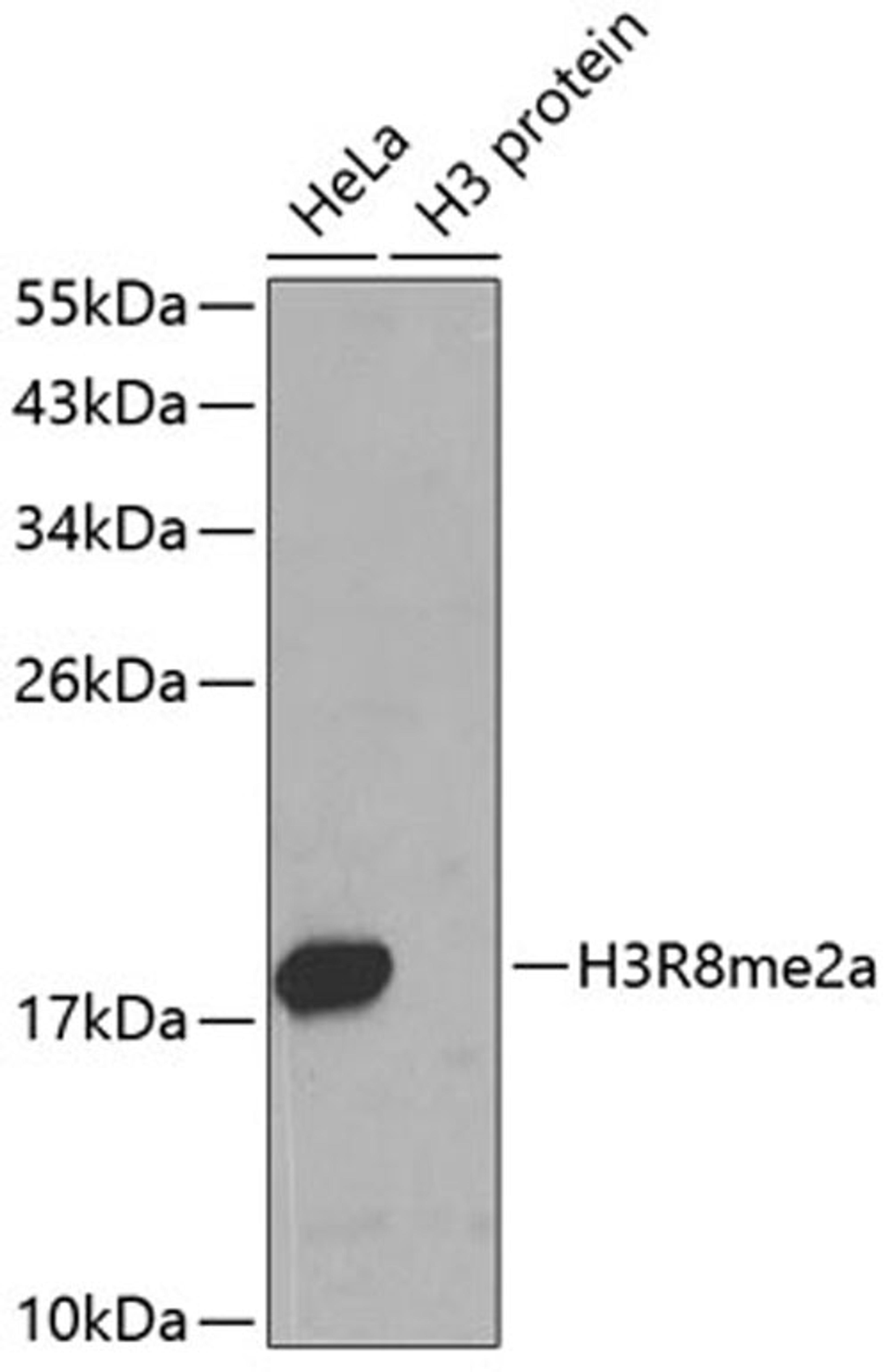 Western blot - Asymmetric DiMethyl-Histone H3-R8 antibody (A3157)