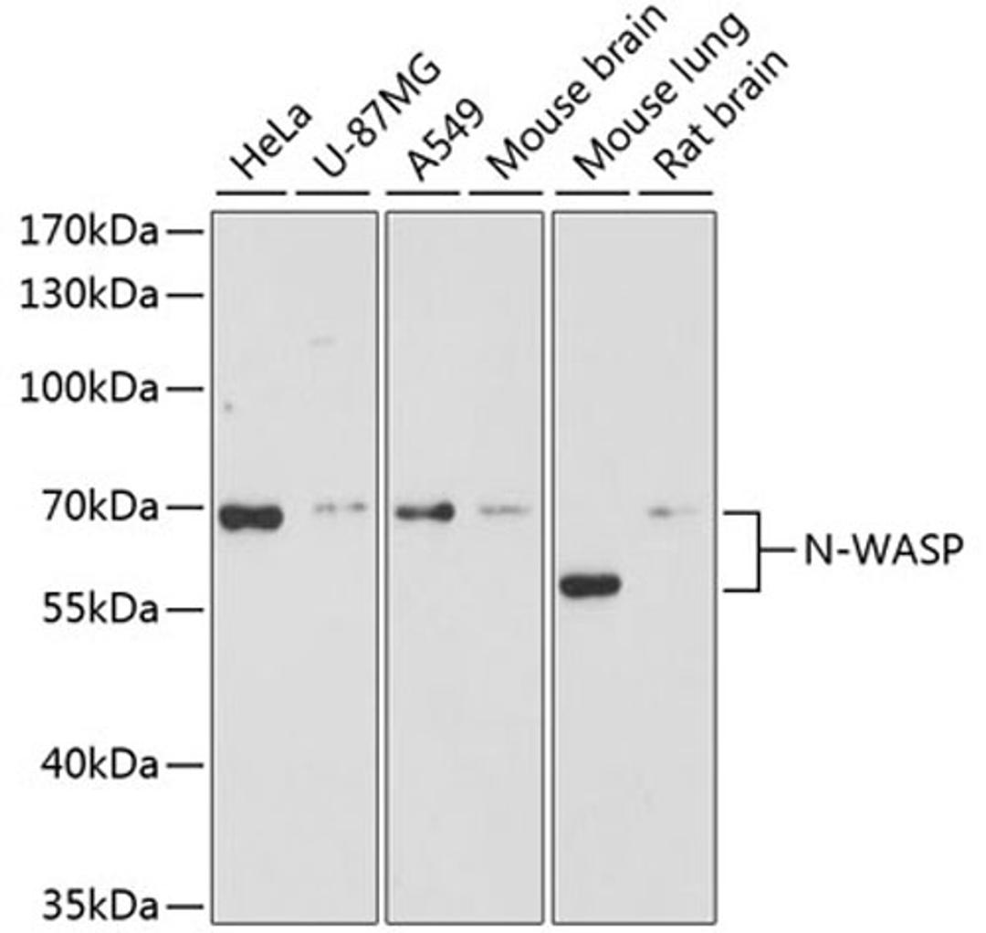 Western blot - N-WASP antibody (A2576)