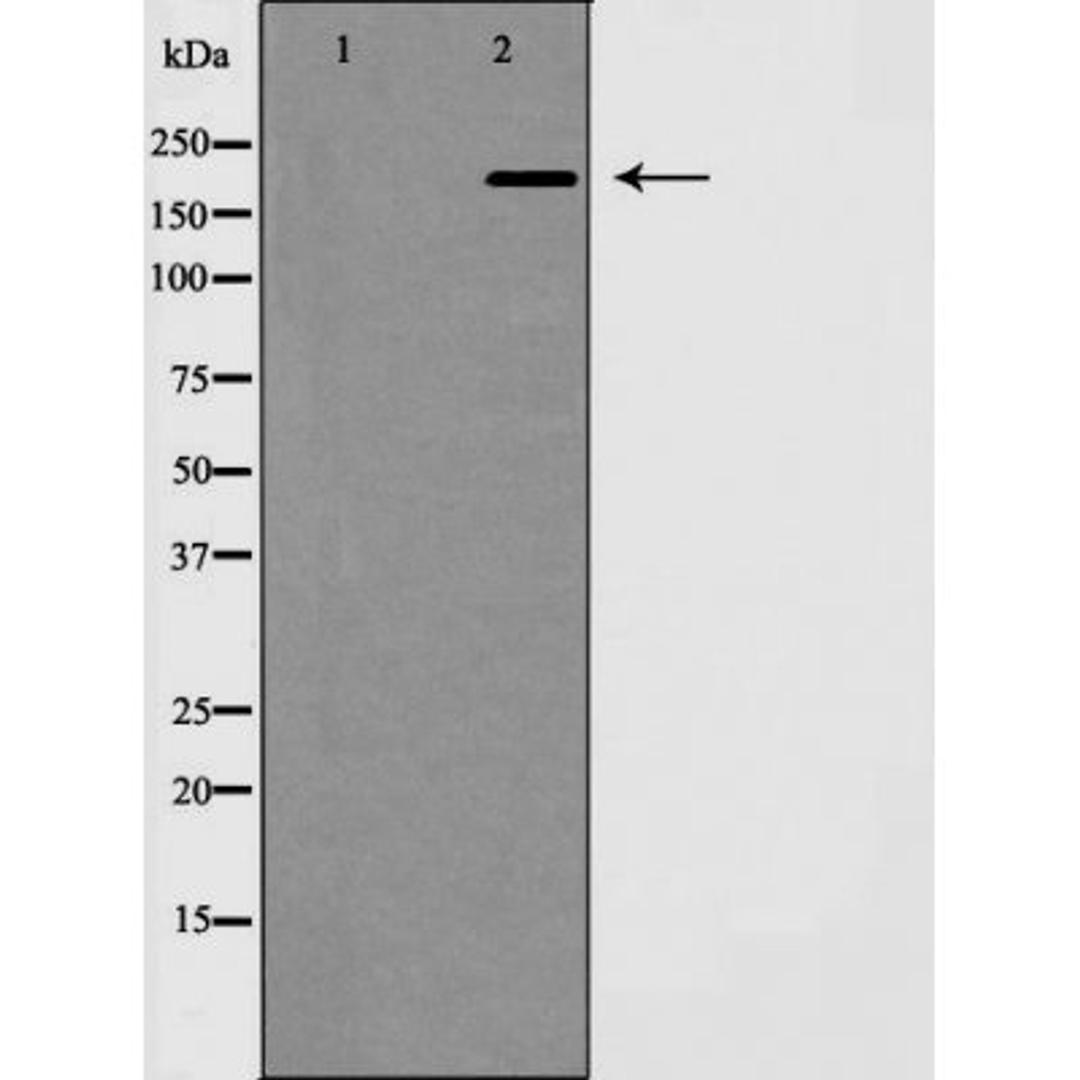 Western blot analysis of mouse brain using MAP 2 antibody