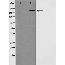 Western blot analysis of mouse brain using MAP 2 antibody