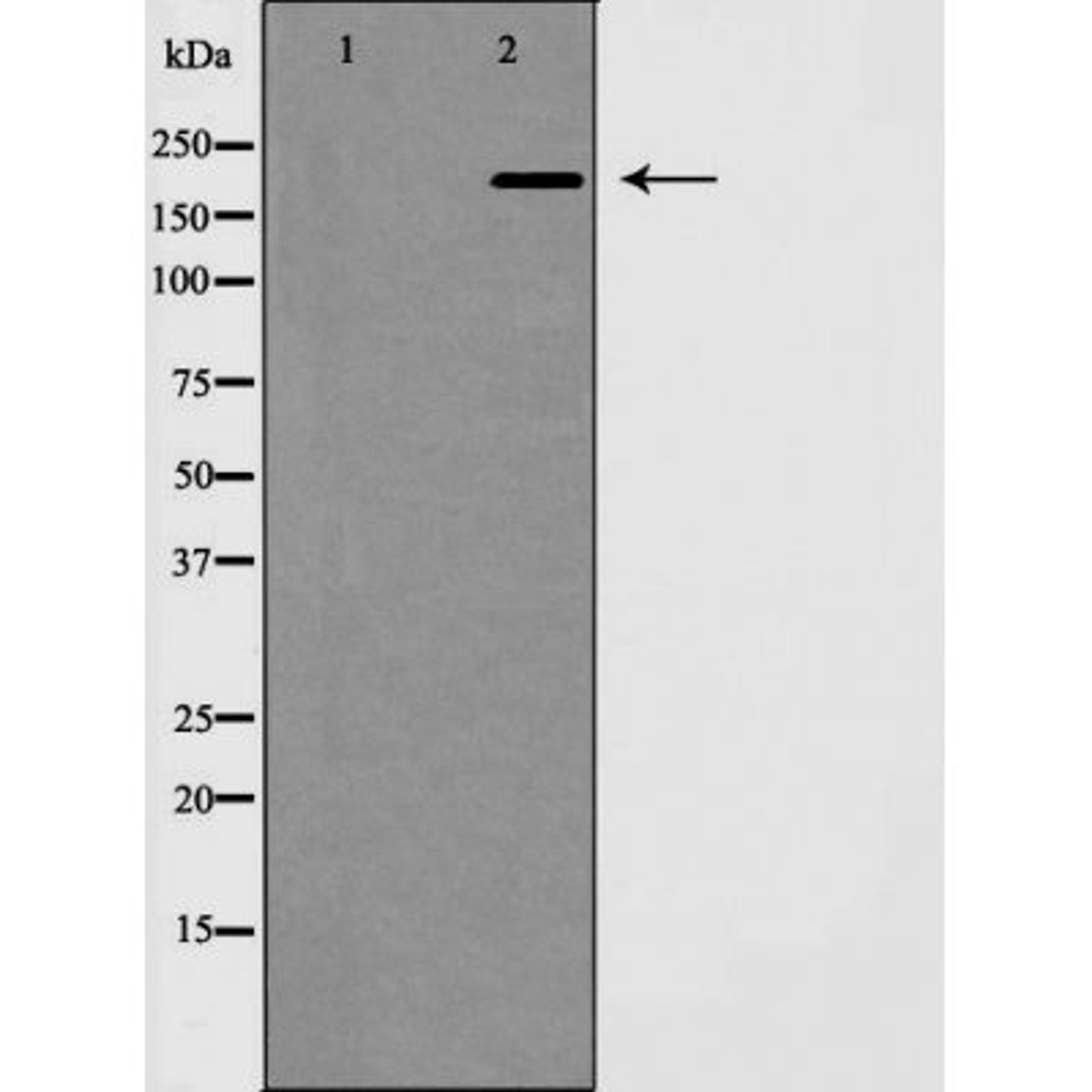 Western blot analysis of mouse brain using MAP 2 antibody