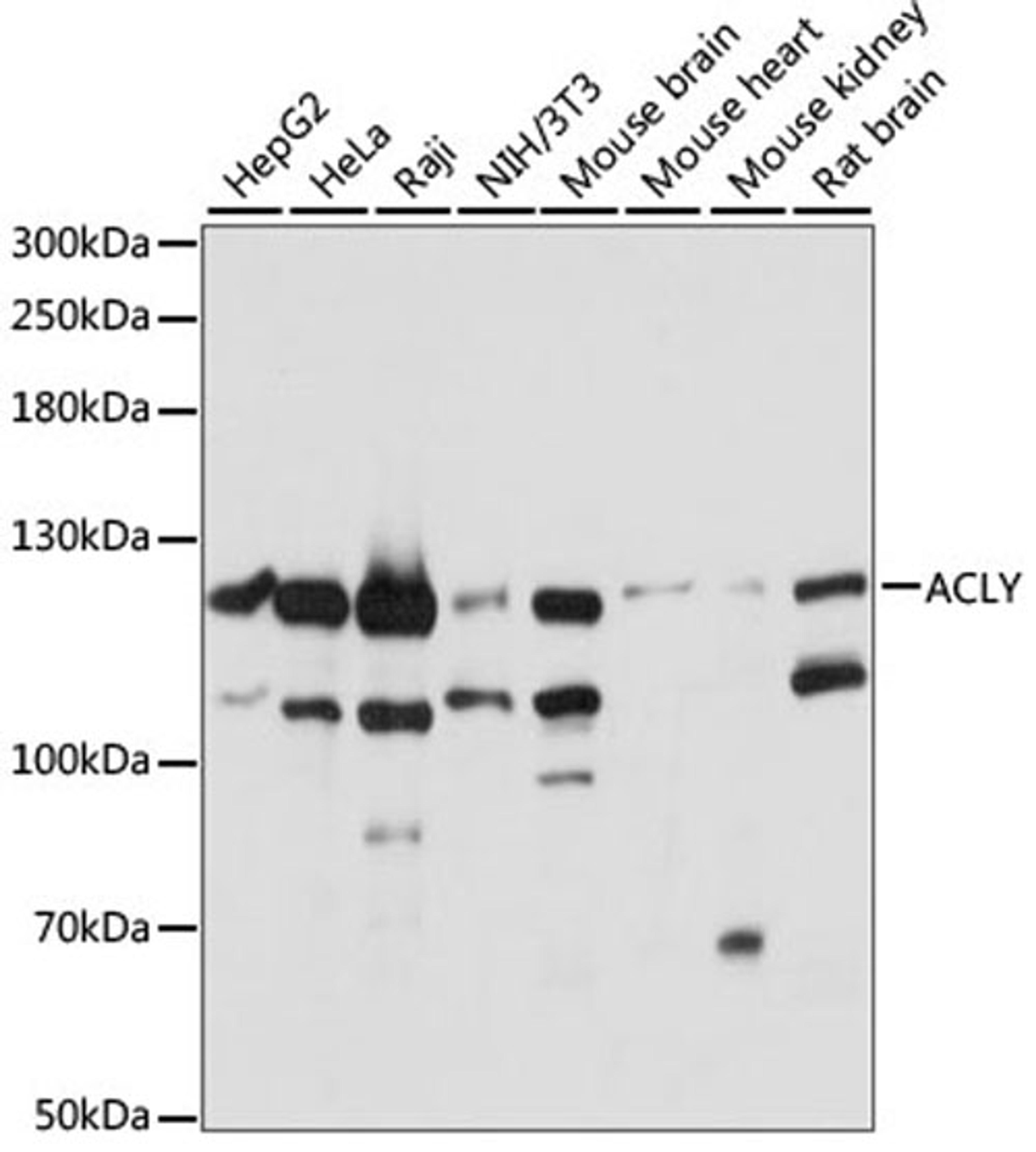 Western blot - ACLY antibody (A15251)