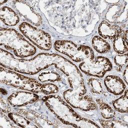 Immunohistochemistry-Paraffin: SLCO4A1 Antibody [NBP1-80977] - Staining of human kidney shows strong cytoplasmic positivity in cells of tubules.