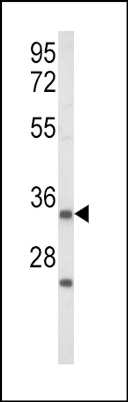 Western blot analysis of IGFBP2 Antibody in Jurkat cell line lysates (35ug/lane)(2ug/ml)