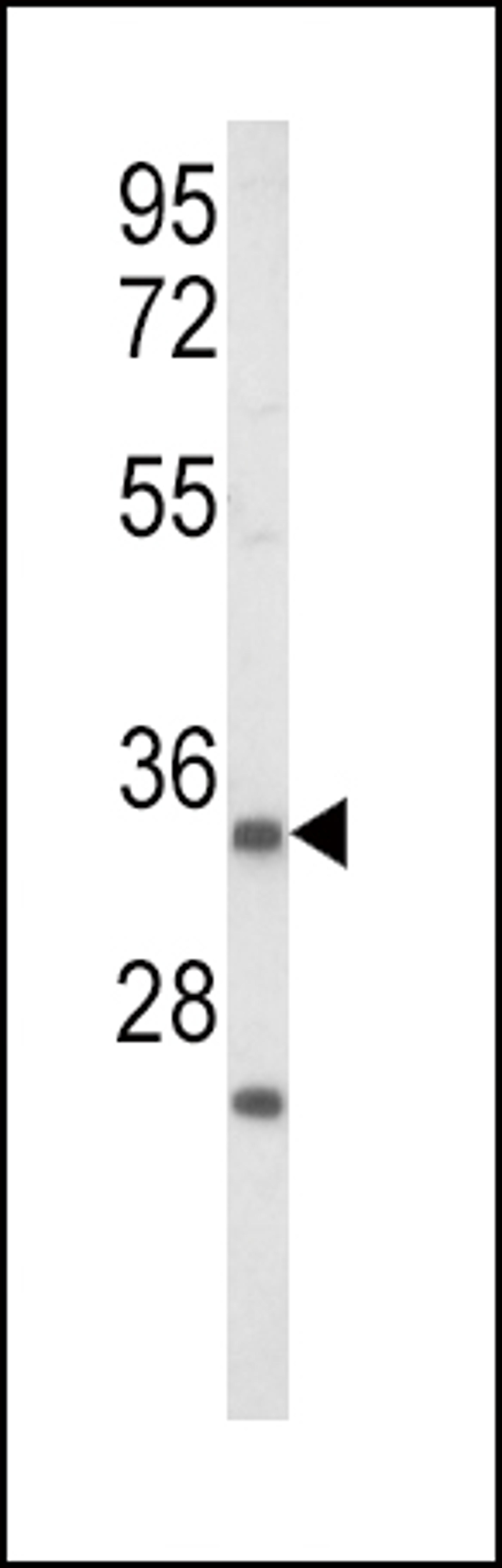 Western blot analysis of IGFBP2 Antibody in Jurkat cell line lysates (35ug/lane)(2ug/ml)