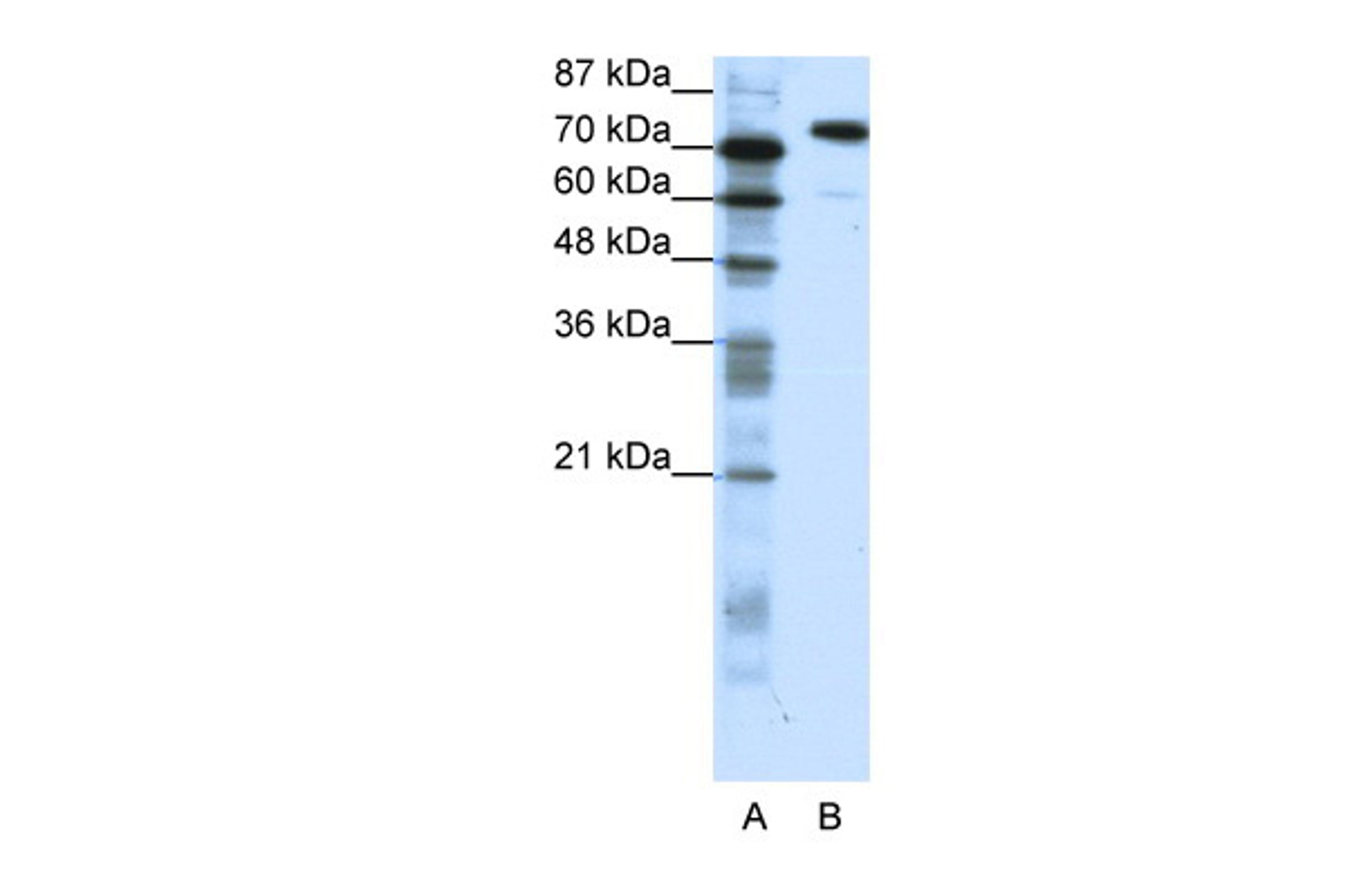 Antibody used in WB on Human Jurkat 1.25 ug/ml.