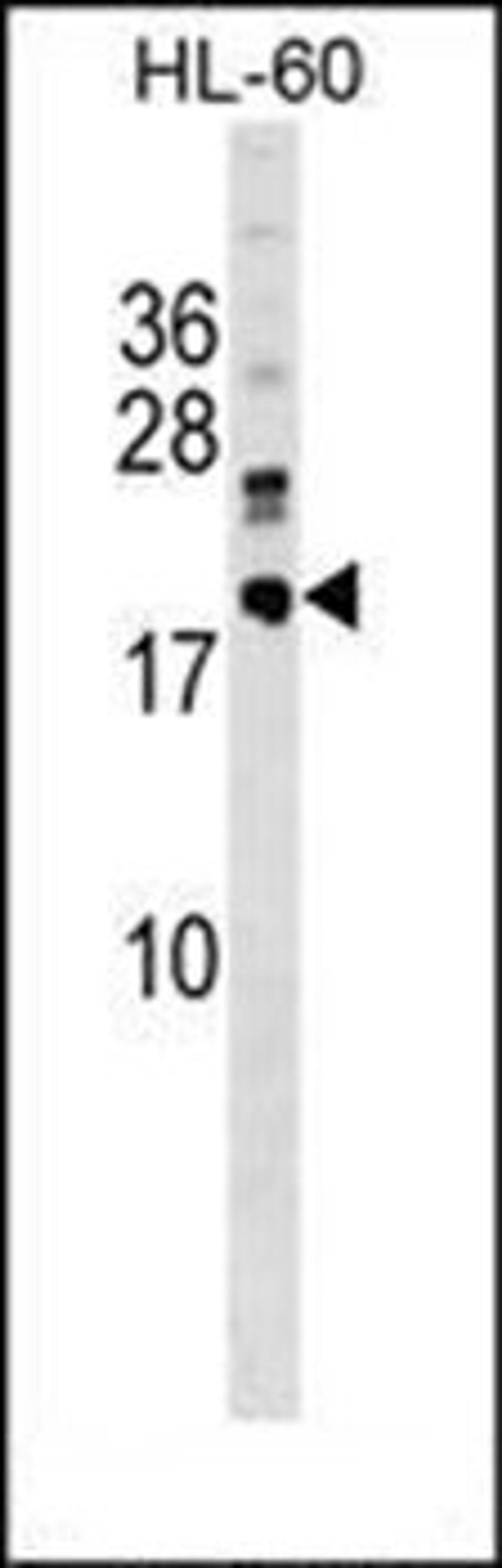 Western blot analysis of HL-60 cell line lysates (35ug/lane) using DNAJC30 antibody (C-term)