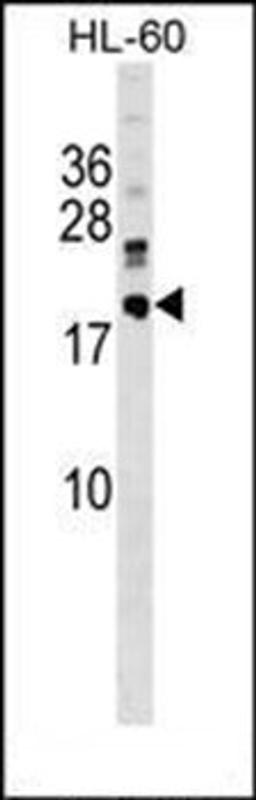 Western blot analysis of HL-60 cell line lysates (35ug/lane) using DNAJC30 antibody (C-term)