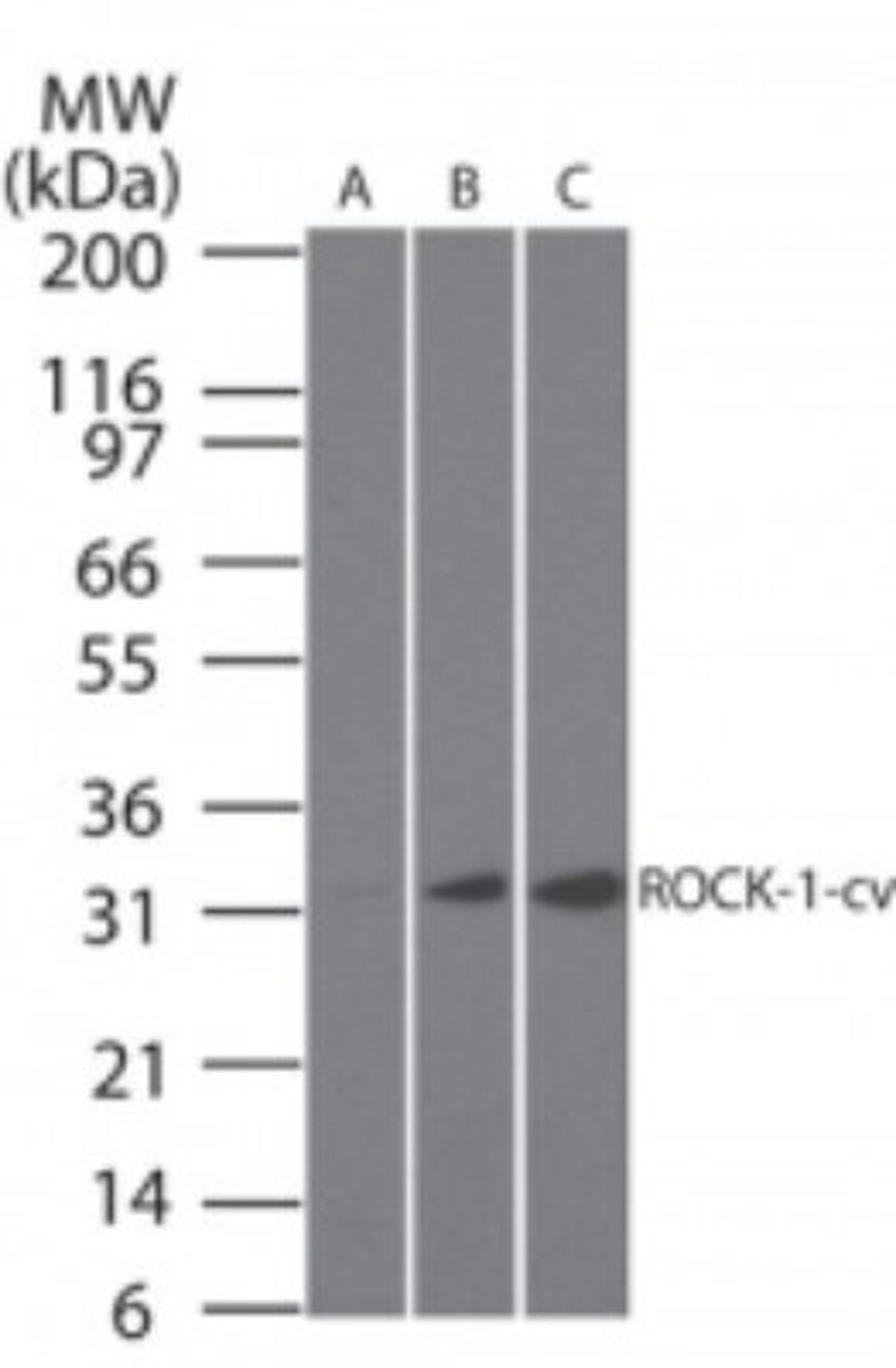 Western Blot: cleaved ROCK1 Antibody (154C1465) [NB100-56596] - Analysis of cleaved ROCK-1 in A) untreated, B) 1 hour and C) 4 hour staurosporin-treated (2 uM) Jurkat cells using this antibody. Goat anti-mouse Ig HRP secondary antibody and PicoTect ECL substrate solution were used for this test.