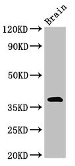 Western Blot. Positive WB detected in: Mouse brain tissue. All lanes: NEUROD6 antibody at 3ug/ml. Secondary. Goat polyclonal to rabbit IgG at 1/50000 dilution. Predicted band size: 39 kDa. Observed band size: 39 kDa. 
