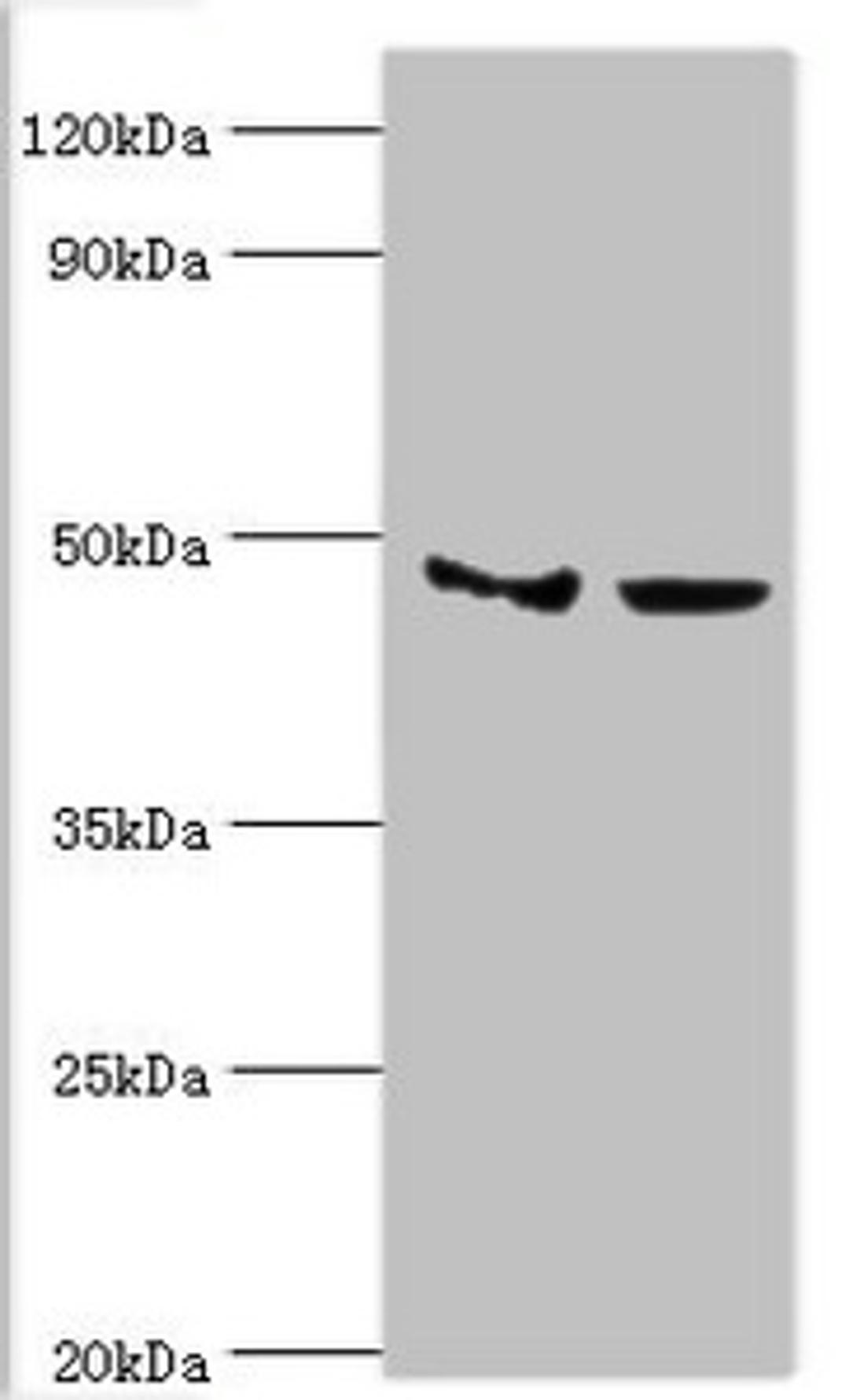 Western blot. All lanes: Histone-lysine N-methyltransferase SMYD3 antibody at 3ug/ml. Lane 1: Hela whole cell lysate. Lane 2: HepG2 whole cell lysate. Secondary. Goat polyclonal to rabbit IgG at 1/10000 dilution. Predicted band size: 50, 30, 43 kDa. Observed band size: 50 kDa. 