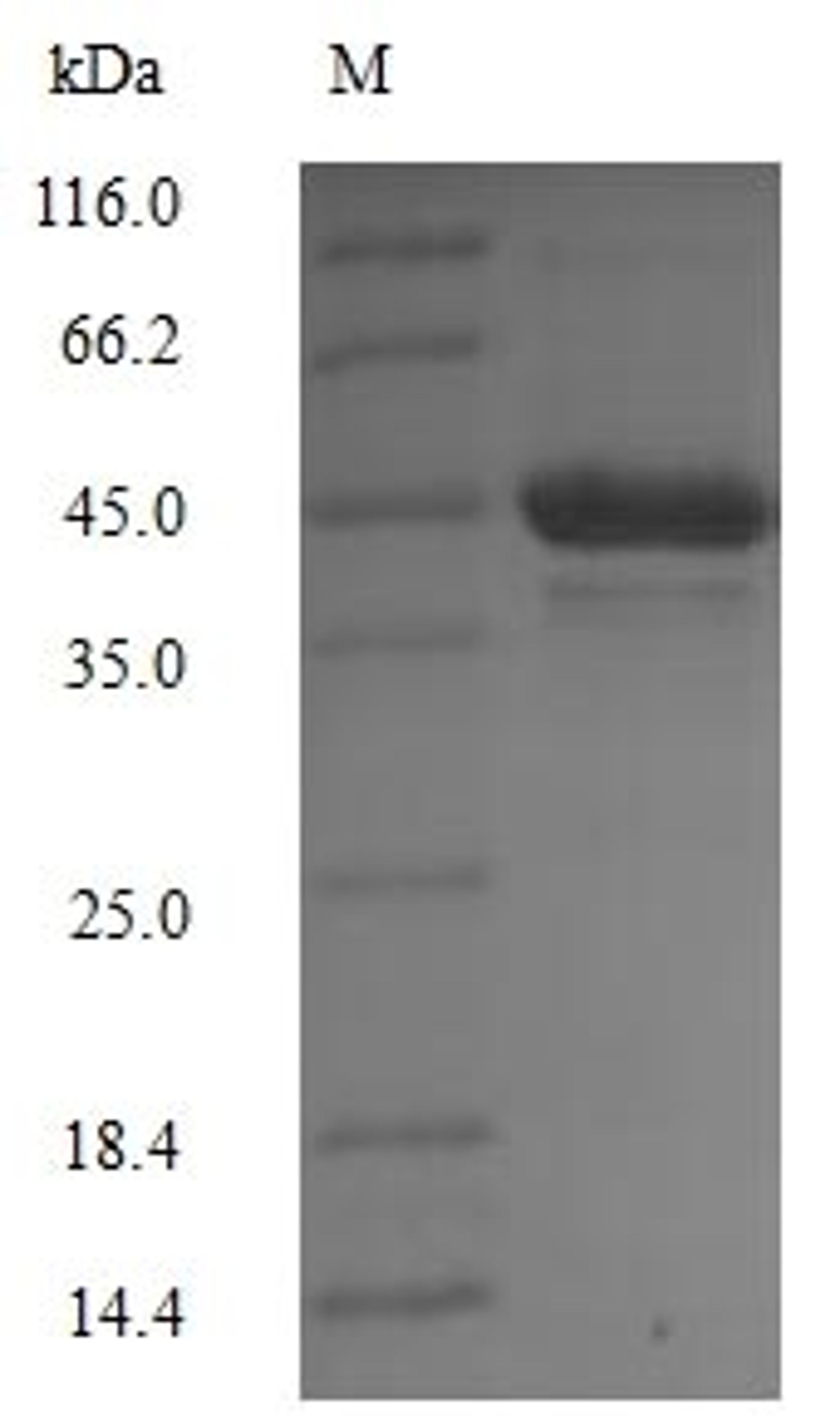 (Tris-Glycine gel) Discontinuous SDS-PAGE (reduced) with 5% enrichment gel and 15% separation gel.