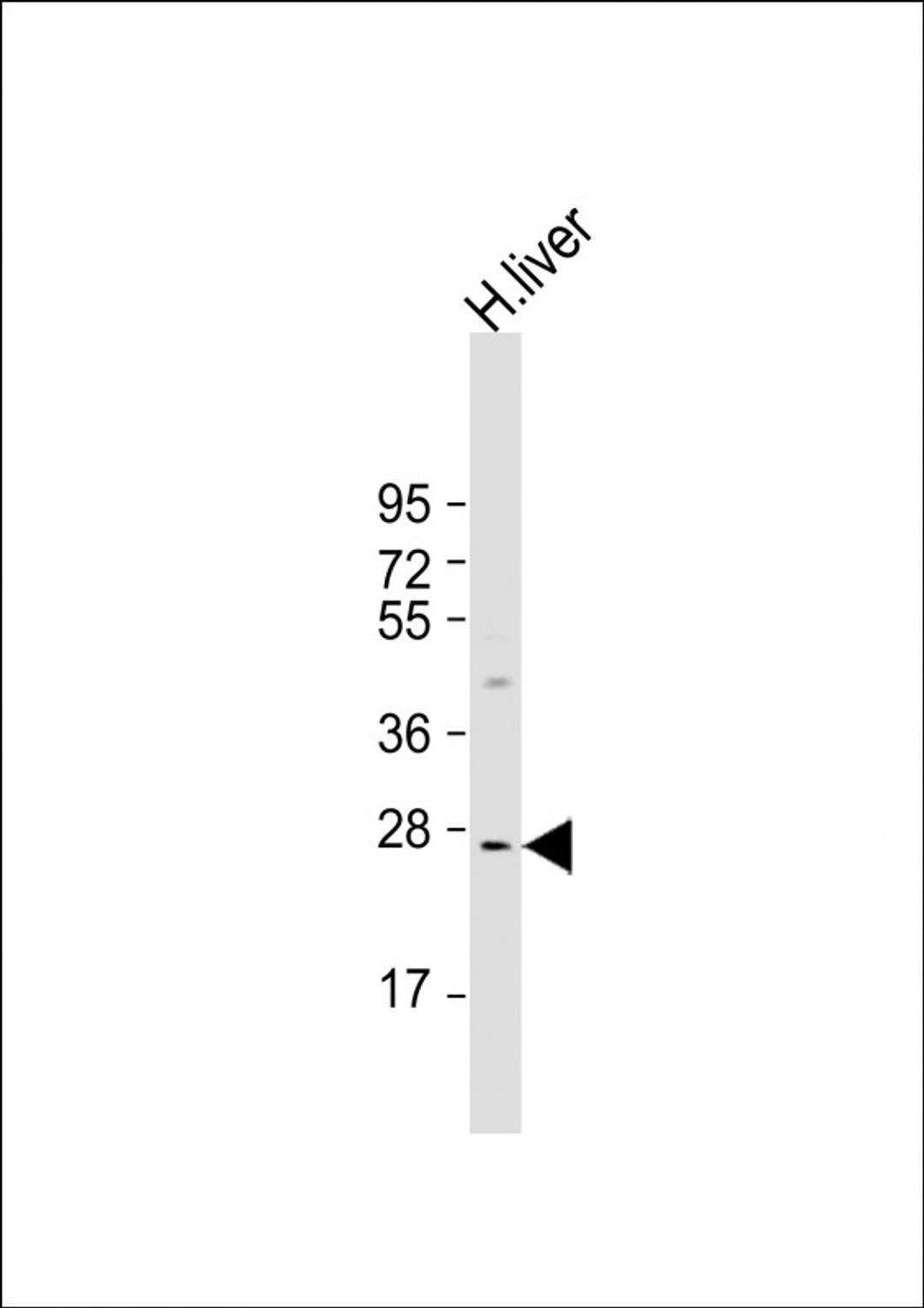 Western Blot at 1:1000 dilution + human liver lysate Lysates/proteins at 20 ug per lane.