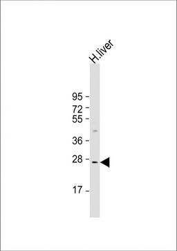 Western Blot at 1:1000 dilution + human liver lysate Lysates/proteins at 20 ug per lane.