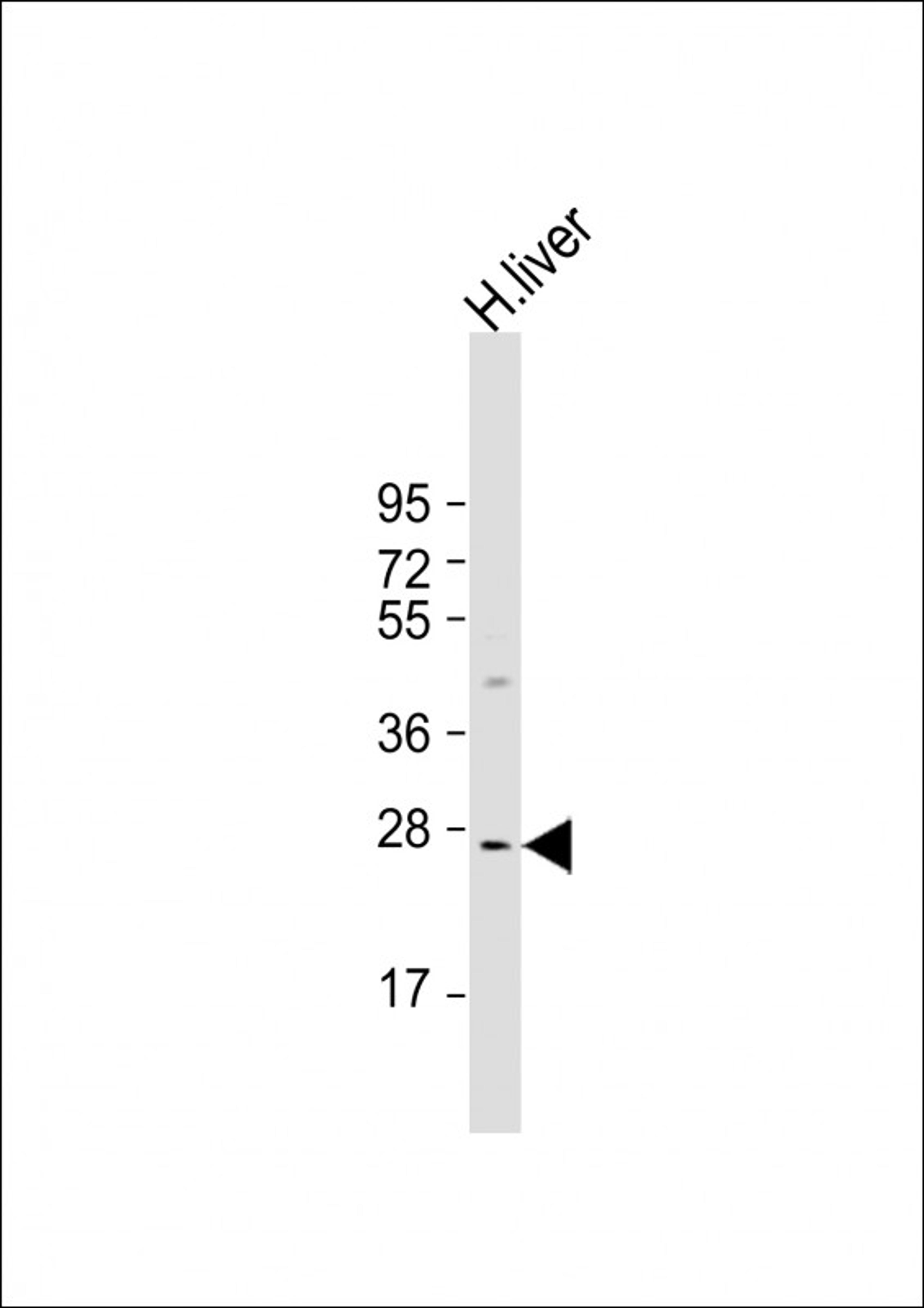 Western Blot at 1:1000 dilution + human liver lysate Lysates/proteins at 20 ug per lane.