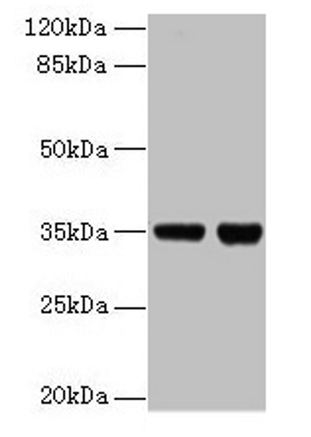 Western blot. All lanes: ZBED1 antibody at 2µg/ml. Lane 1: EC109 whole cell lysate. Lane 2: 293T whole cell lysate. Secondary. Goat polyclonal to rabbit IgG at 1/15000 dilution. Predicted band size: 79 kDa. Observed band size: 35 kDa
