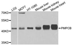 Western blot analysis of extracts of various cells using PMPCB antibody