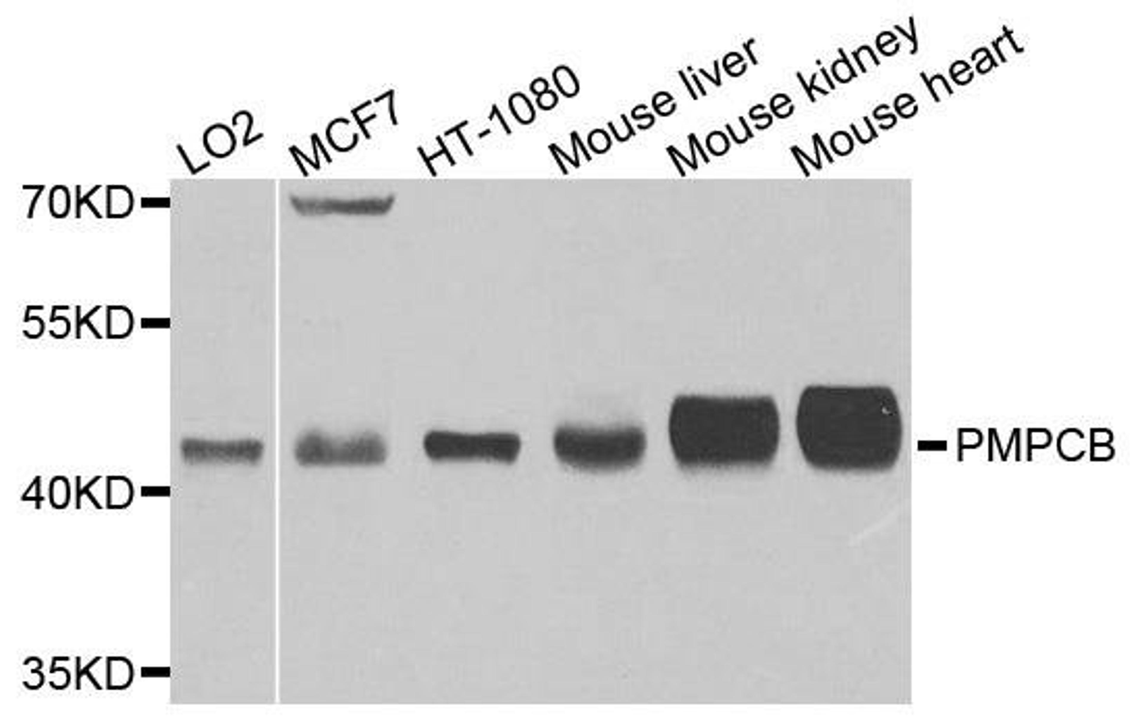 Western blot analysis of extracts of various cells using PMPCB antibody