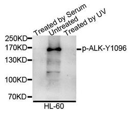 Western blot analysis of extracts of various cell lines using ALK (Phospho-Y1096) antibody