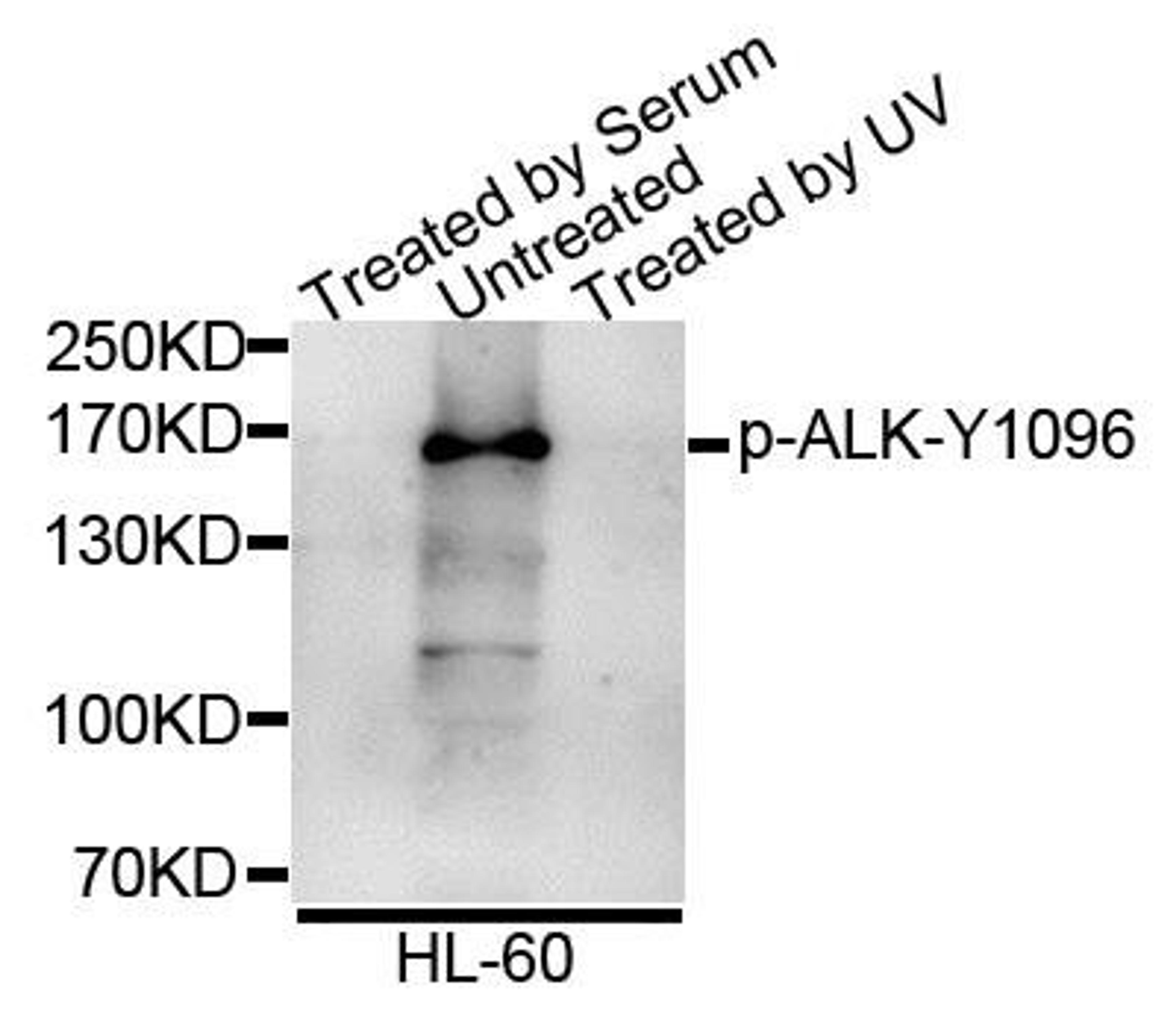 Western blot analysis of extracts of various cell lines using ALK (Phospho-Y1096) antibody