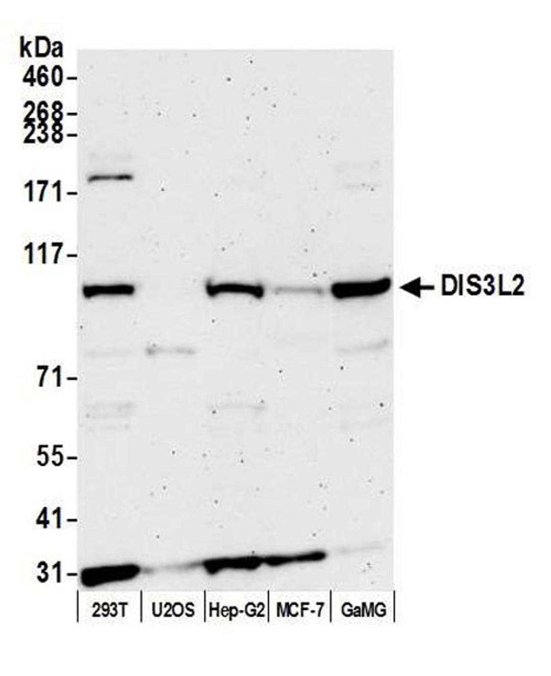 Detection of human DIS3L2 by WB.