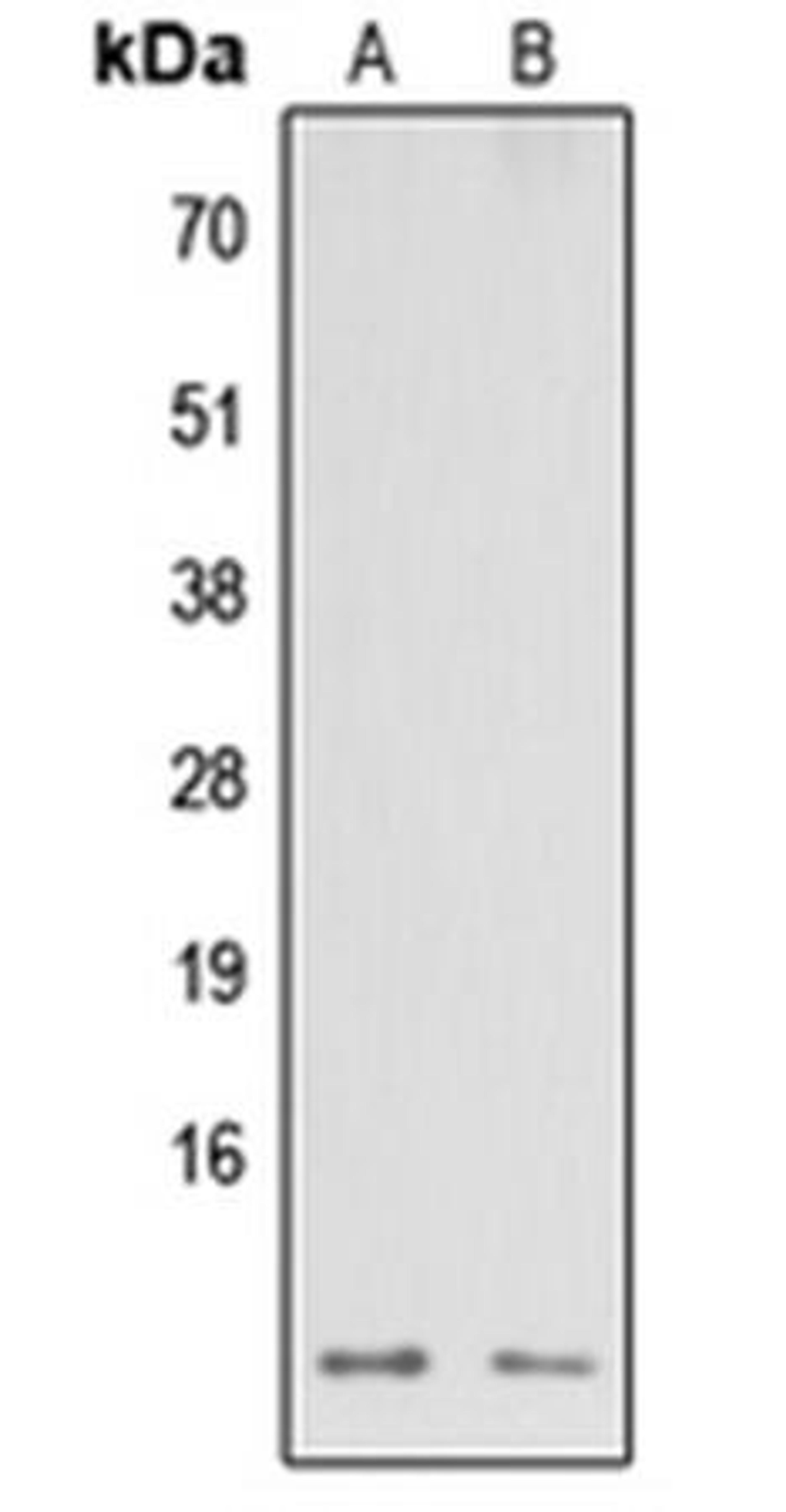 Western blot analysis of HEK293T (Lane1), Raw264.7 (Lane2) whole cell using NDUFA3 antibody