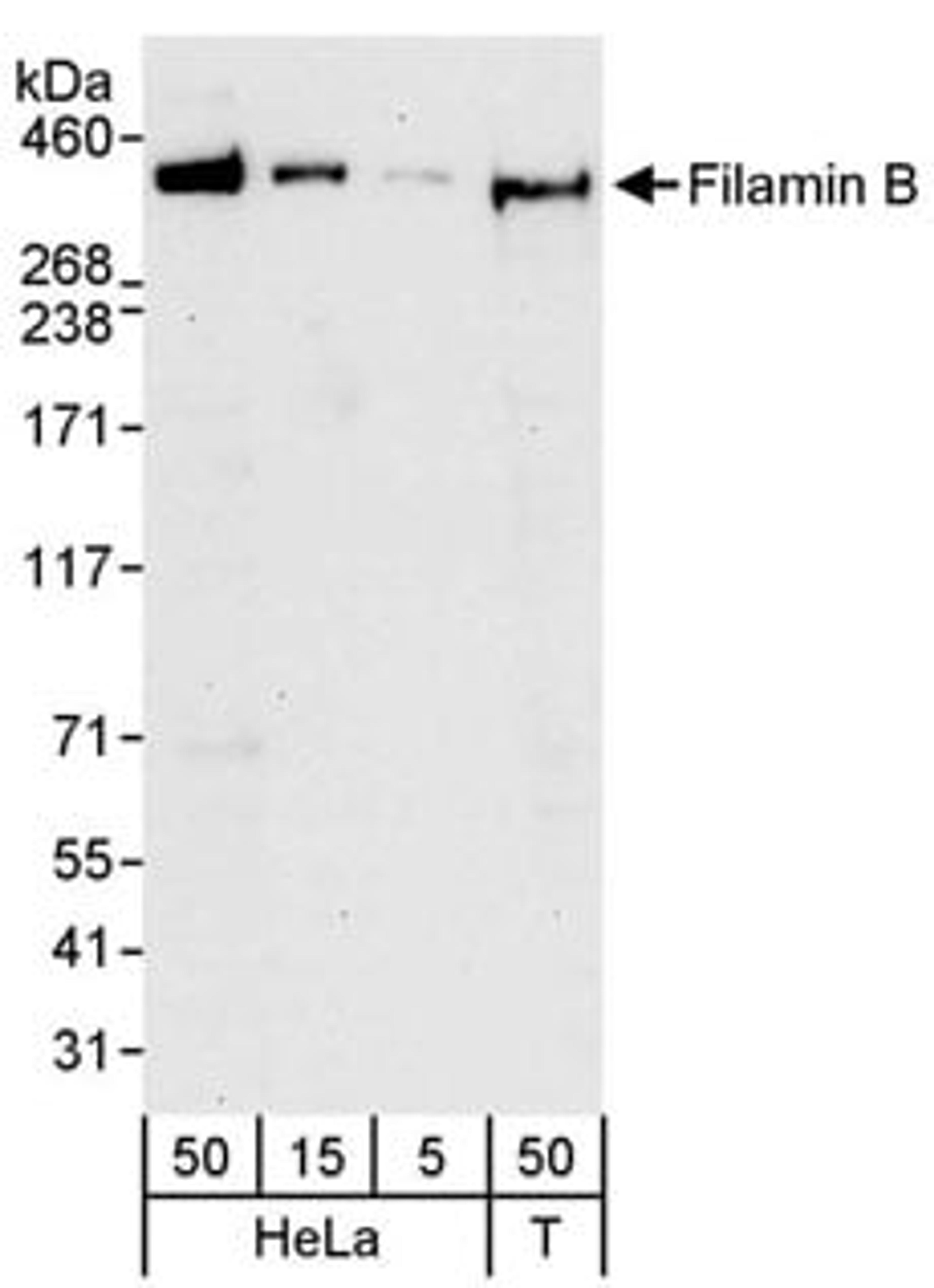 Detection of human Filamin B by western blot.