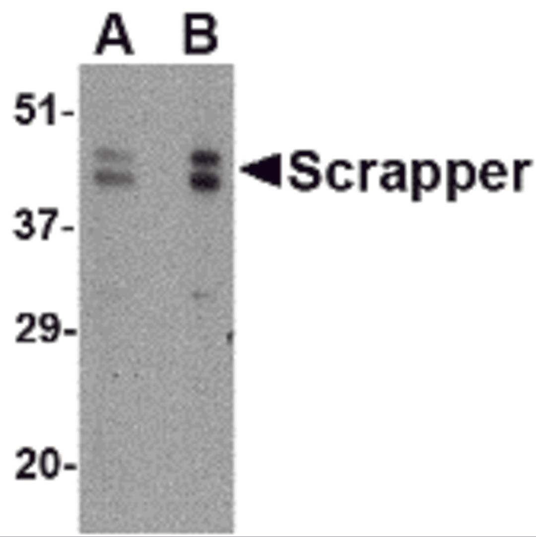 Western blot analysis of SCRAPPER in A20 cell lysate with SCRAPPER antibody at (A) 0.5 and (B) 1 &#956;g/mL.