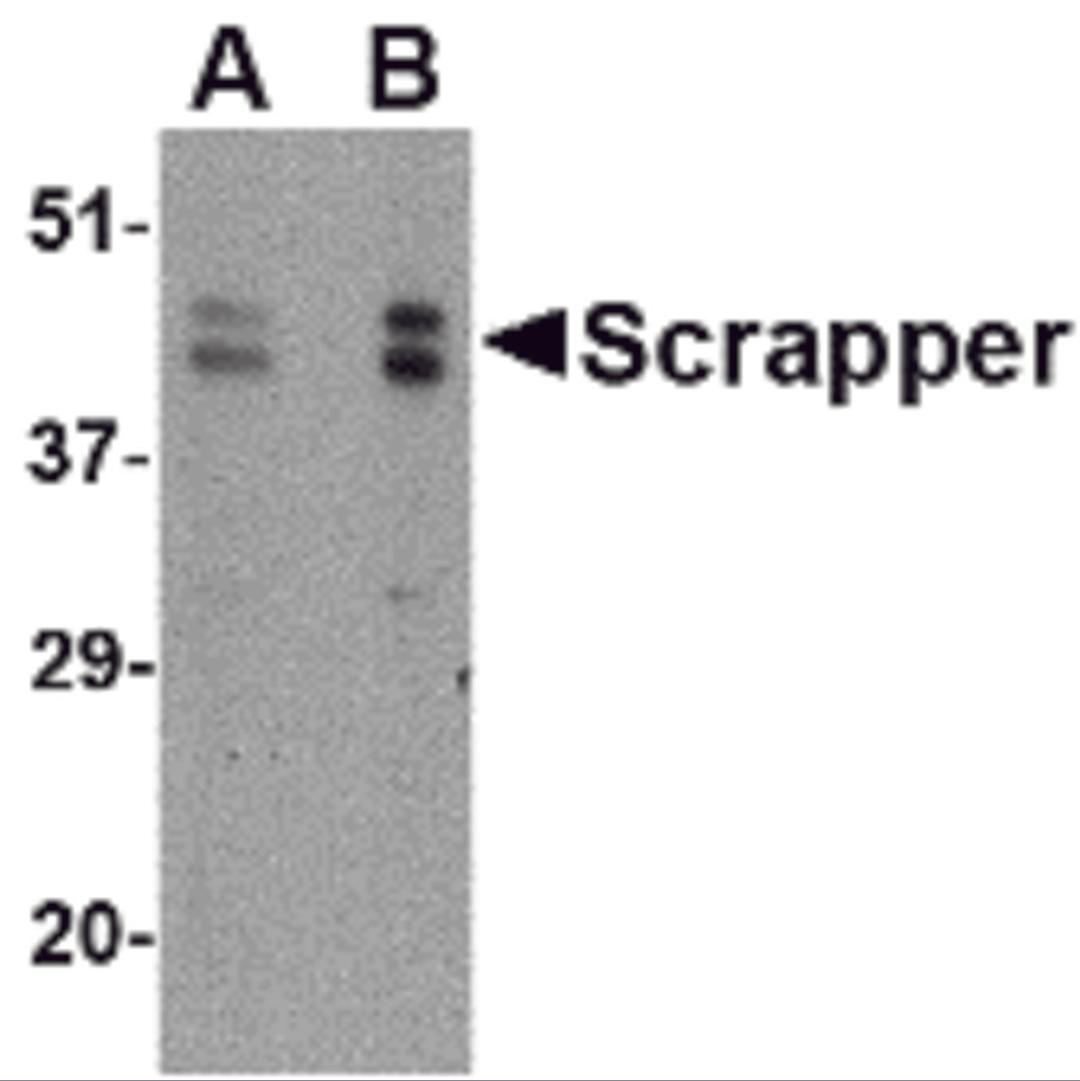 Western blot analysis of SCRAPPER in A20 cell lysate with SCRAPPER antibody at (A) 0.5 and (B) 1 μg/mL.