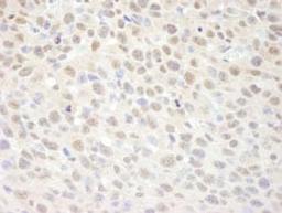 Detection of mouse SUPT6H by immunohistochemistry.