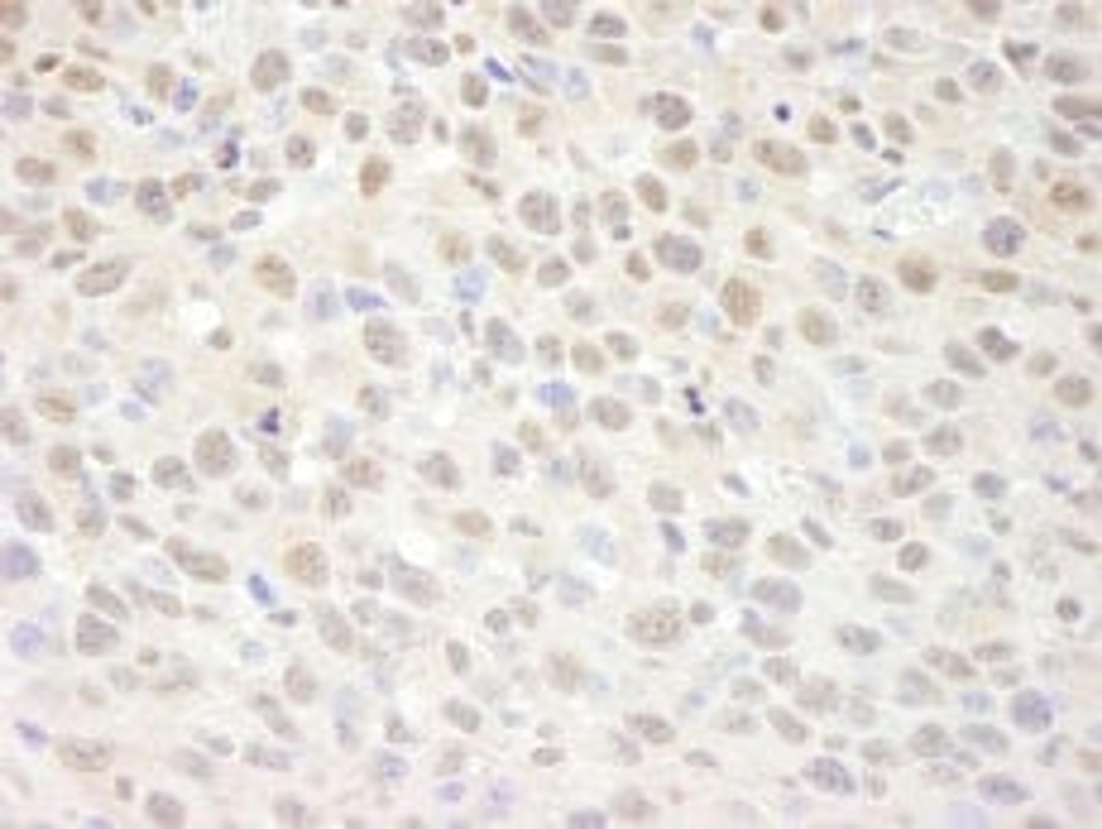 Detection of mouse SUPT6H by immunohistochemistry.