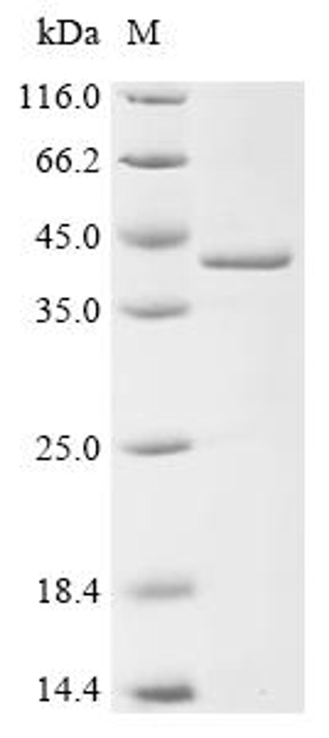 (Tris-Glycine gel) Discontinuous SDS-PAGE (reduced) with 5% enrichment gel and 15% separation gel.