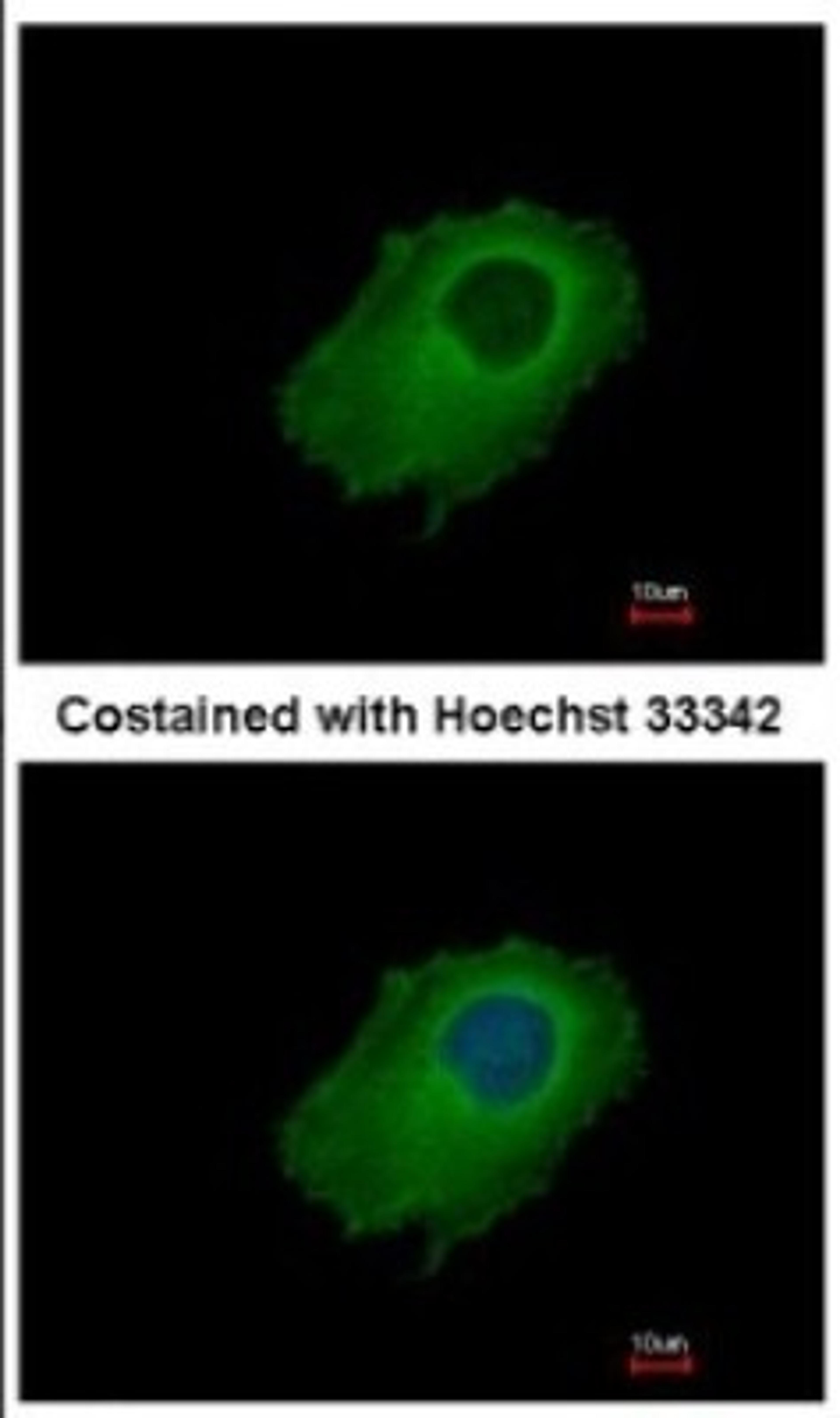 Immunocytochemistry/Immunofluorescence: SERPINE2 Antibody [NBP2-20315] - Immunofluorescence analysis of methanol-fixed HeLa, using antibody at 1:500 dilution.