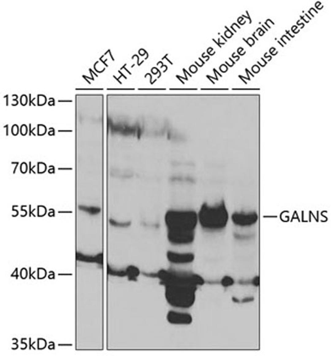 Western blot - GALNS antibody (A5461)