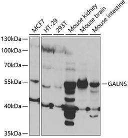 Western blot - GALNS antibody (A5461)