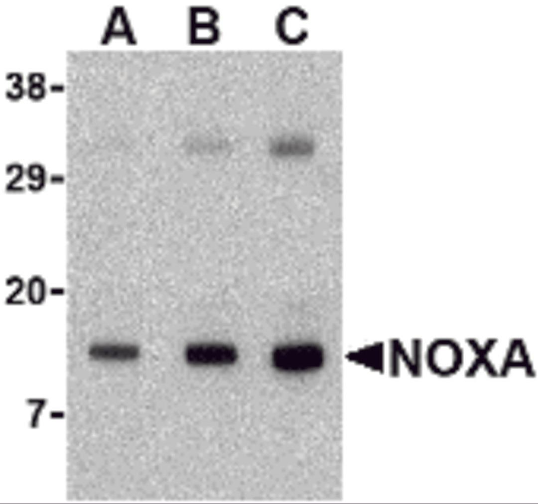 Western blot analysis of Noxa in human stomach tissue lysate with Noxa antibody at (A) 0.5, (B) 1 and (C) 2 μg/mL.