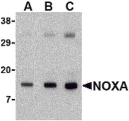 Western blot analysis of Noxa in human stomach tissue lysate with Noxa antibody at (A) 0.5, (B) 1 and (C) 2 μg/mL.