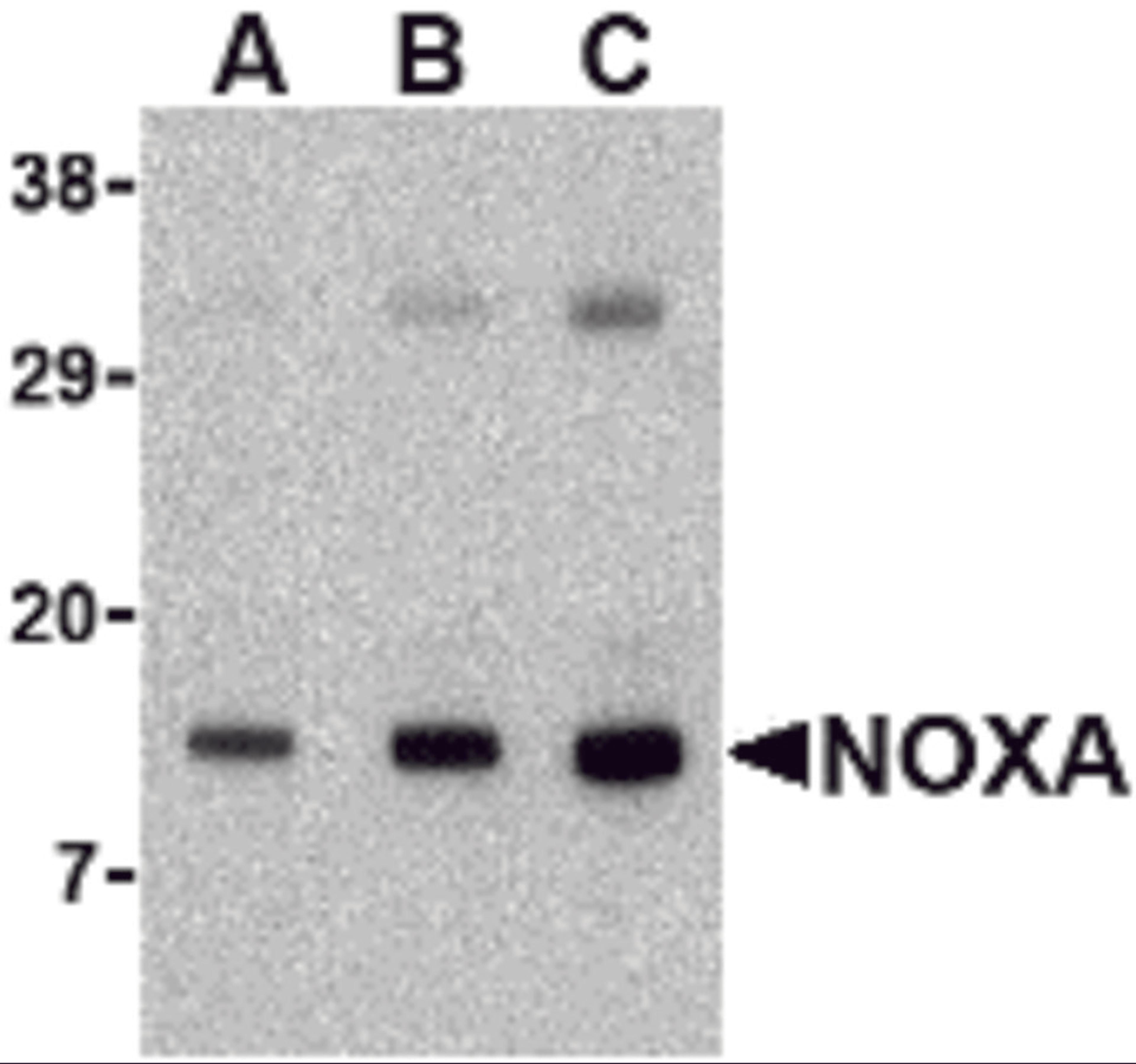 Western blot analysis of Noxa in human stomach tissue lysate with Noxa antibody at (A) 0.5, (B) 1 and (C) 2 μg/mL.