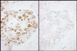 Detection of human Phospho-RNA Polymerase II (S2) by immunohistochemistry.