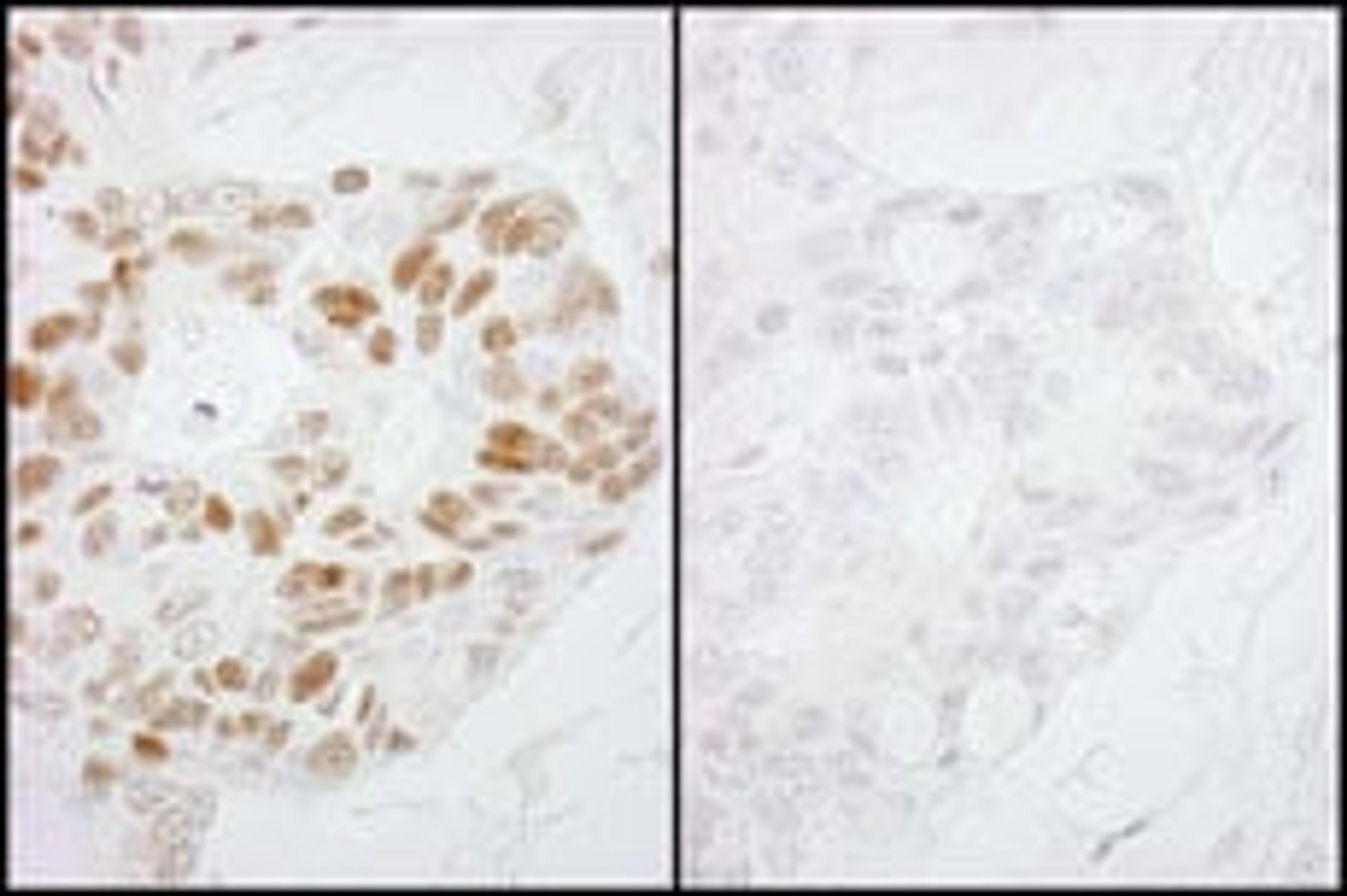 Detection of human Phospho-RNA Polymerase II (S2) by immunohistochemistry.