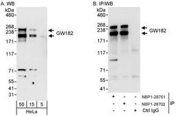 Western Blot: GW182 Antibody [NBP1-28751] - Samples: Whole cell lysate (5, 15 and 50 ug for WB; 1 mg for IP, 20% of IP loaded) from HeLa cells.   Antibodies: Affinity purified rabbit anti-GW182 antibody NBP1-28751 used for WB at 0.1 ug/ml (A) and 0.4 ug/ml (B) and used for IP at 10 ug/mg lysate.  GW182 was also immunoprecipitated by rabbit anti-GW182 antibody NBP1-28702, which recognizes a downstream epitope.  Detection: Chemiluminescence with exposure times of 3 minutes (A) and 30 seconds (B).