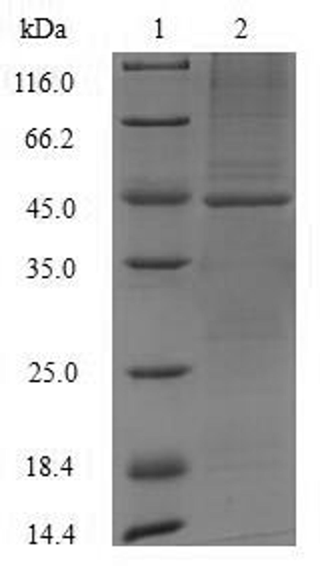 (Tris-Glycine gel) Discontinuous SDS-PAGE (reduced) with 5% enrichment gel and 15% separation gel.