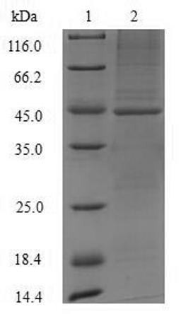 (Tris-Glycine gel) Discontinuous SDS-PAGE (reduced) with 5% enrichment gel and 15% separation gel.