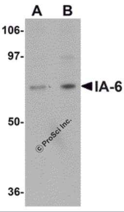 Western blot analysis of IA-6 in rat thymus tissue lysate with IA-6 antibody at (A) 1 and (B) 2 &#956;g/mL. 