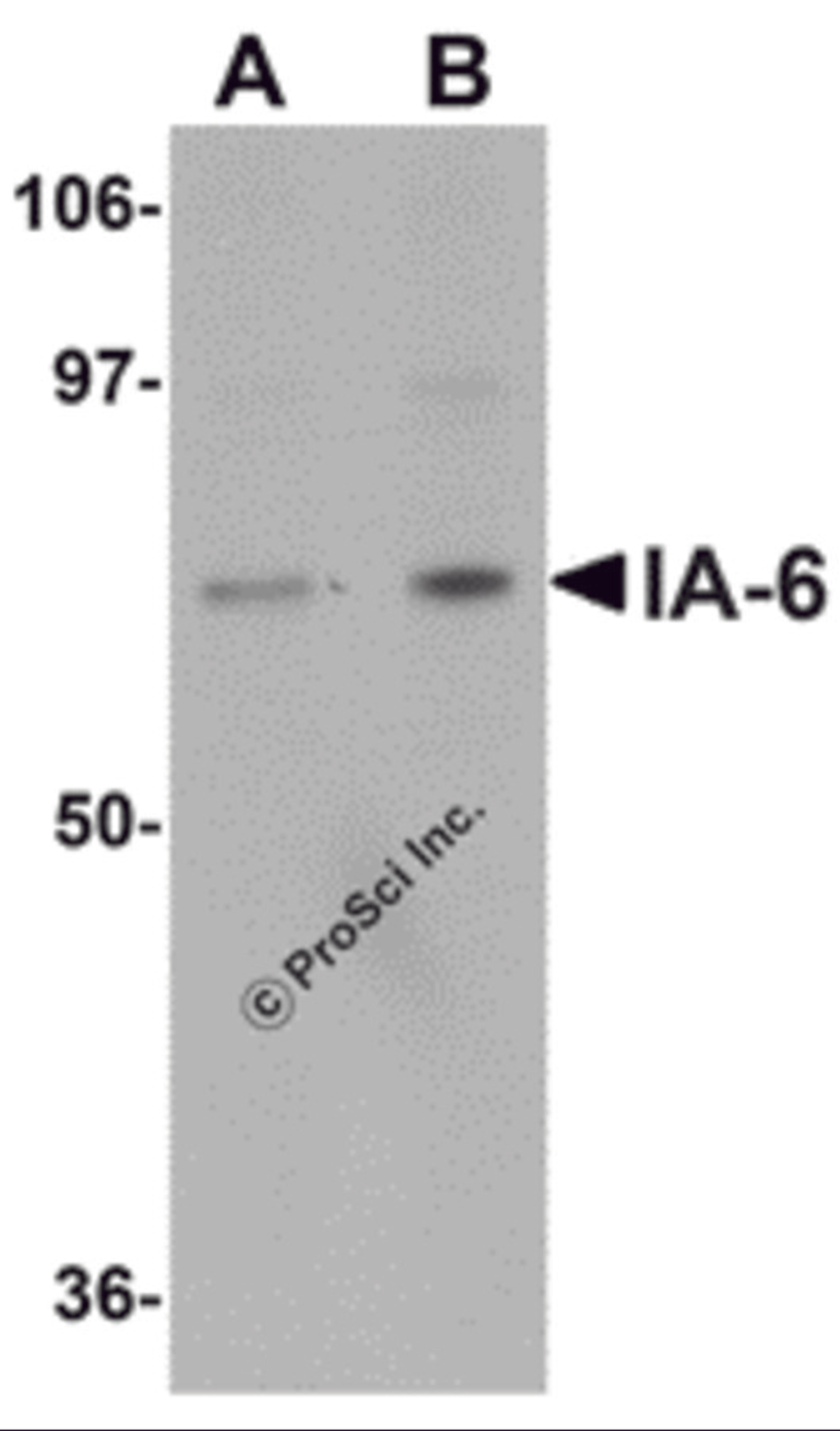 Western blot analysis of IA-6 in rat thymus tissue lysate with IA-6 antibody at (A) 1 and (B) 2 &#956;g/mL. 