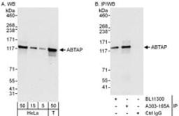 Detection of human ABTAP by western blot and immunoprecipitation.