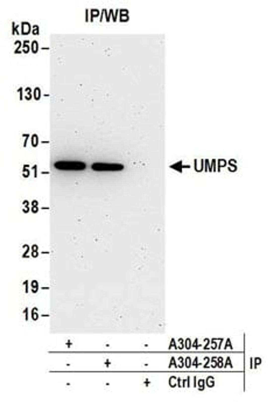 Detection of human UMPS by western blot of immunoprecipitates.