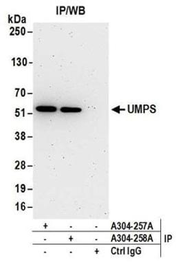 Detection of human UMPS by western blot of immunoprecipitates.