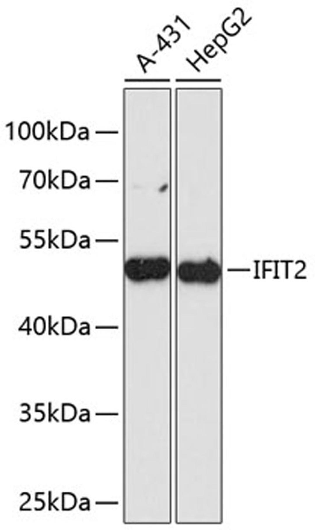 Western blot - IFIT2 antibody (A13760)