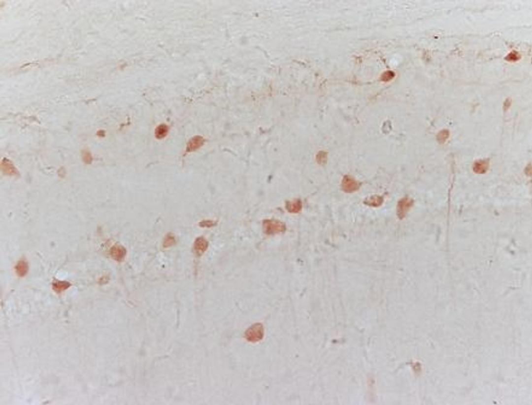 Immunohistochemical analysis of frozen mouse brain tissue using 5HT1A Receptor antibody